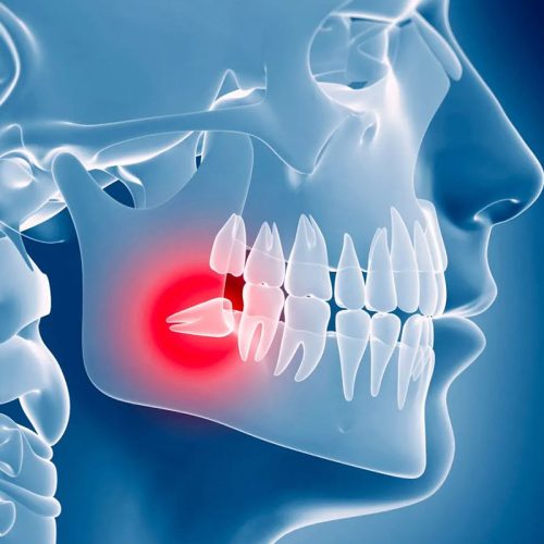 CHIRURGIA E IMPLANTOLOGIA