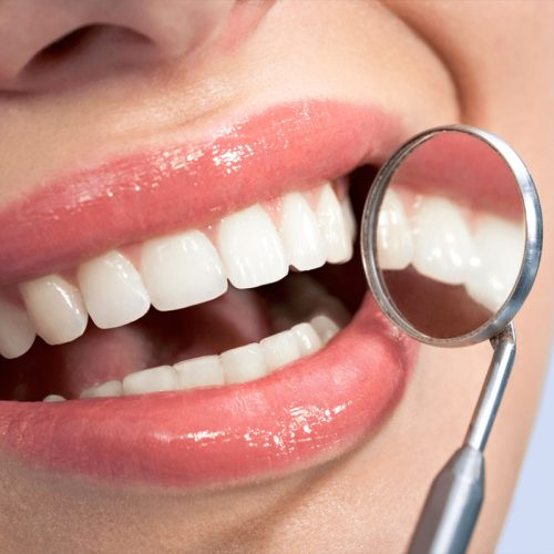 IGIENE E TERAPIA PARODONTALE